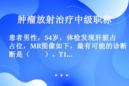 患者男性，54岁，体检发现肝脏占位，MR图像如下，最有可能的诊断是（　　）。T1WIT2WI动脉期增...