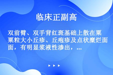 双前臂、双手背红斑基础上散在粟粒大小丘疹、丘疱疹及点状糜烂面，有明显浆液性渗出，边界不清，皮疹对称分...