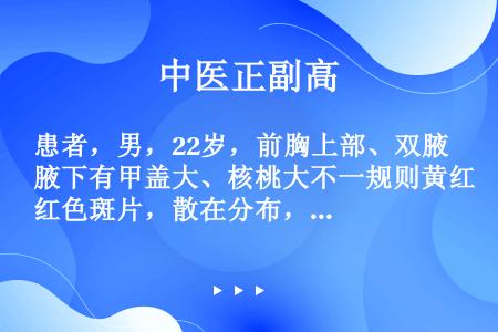 患者，男，22岁，前胸上部、双腋下有甲盖大、核桃大不一规则黄红色斑片，散在分布，红斑上有鳞屑，瘙痒1...