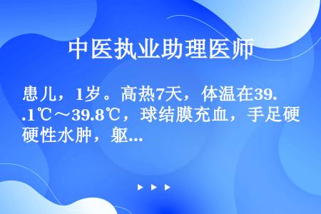 患儿，1岁。高热7天，体温在39.1℃～39.8℃，球结膜充血，手足硬性水肿，躯干部出现皮疹，经抗生...