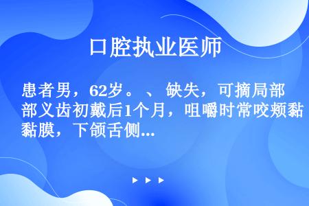 患者男，62岁。 、 缺失，可摘局部义齿初戴后1个月，咀嚼时常咬颊黏膜，下颌舌侧第一磨牙至牙后垫区压...