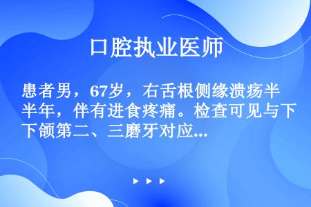 患者男，67岁，右舌根侧缘溃疡半年，伴有进食疼痛。检查可见与下颌第二、三磨牙对应处有舌缘溃疡，1cm...