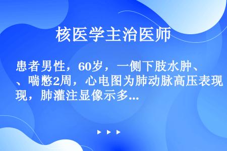 患者男性，60岁，一侧下肢水肿、喘憋2周，心电图为肺动脉高压表现，肺灌注显像示多发性放射性缺损区，肺...