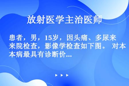 患者，男，15岁，因头痛、多尿来院检查，影像学检查如下图。  对本病最具有诊断价值的是（）