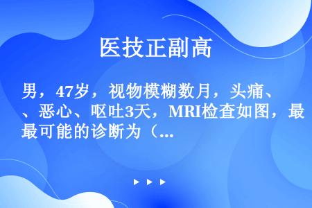 男，47岁，视物模糊数月，头痛、恶心、呕吐3天，MRI检查如图，最可能的诊断为（）