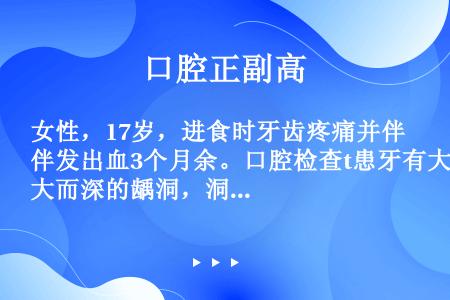 女性，17岁，进食时牙齿疼痛并伴发出血3个月余。口腔检查t患牙有大而深的龋洞，洞内有红色肉芽组织，触...