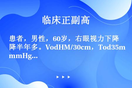 患者，男性，60岁，右眼视力下降半年多。VodHM/30cm，Tod35mmHg，右眼无充血，角膜透...